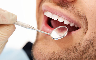 Man's healthy smile in dental check-up